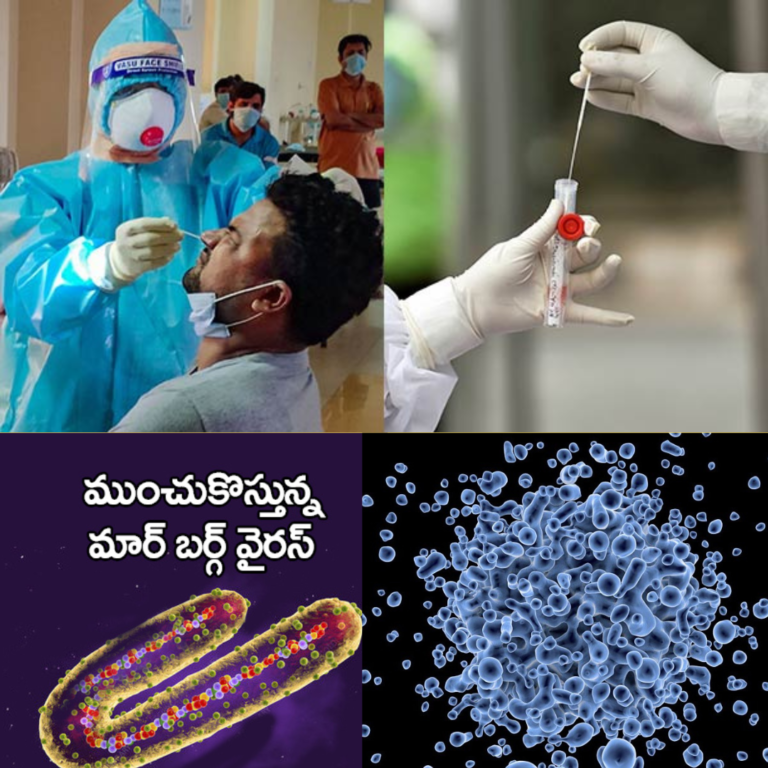 వణికిస్తున్న మార్ బర్గ్ వైరస్ : సోకిందంటే చావే